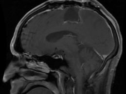 can technology drive high healthcare-costs