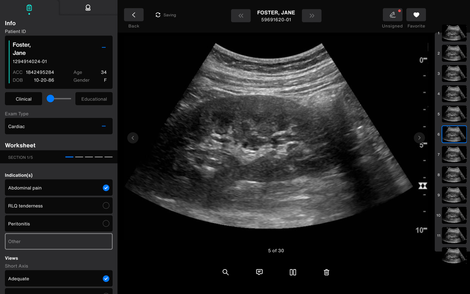 Addressing Point-of-Care Ultrasound&rsquo;s Shadow IT Problem