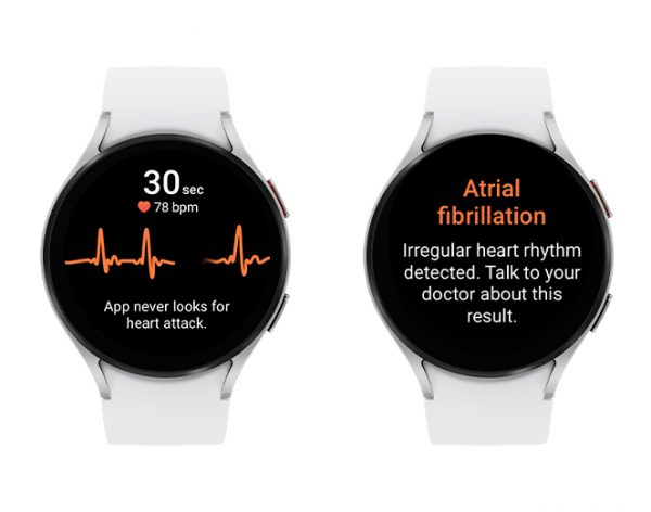 FDA Clears Samsung&rsquo;s Irregular Heart Rhythm Notification