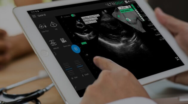 FDA Grants Clearance for UltraSight's AI Cardiac Ultrasound