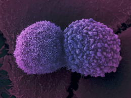 Is Artificial Intelligence the Key to Curing Cancer